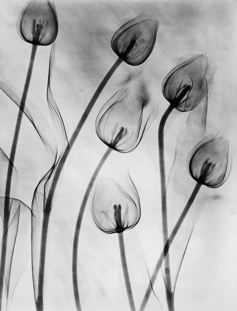 X-Ray Tulips On White